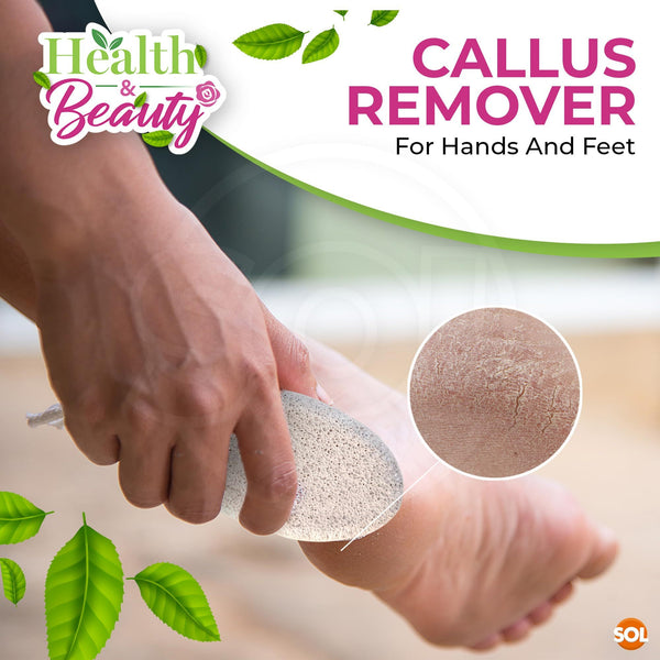 SOL 8pk Natural Pumice Stone for Feet | Callus Remover & Foot Scrubber | Exfoliating Stone for Dead Skin, Hard Skin, and Cracked Heels | Gentle Foot Buffer for Smooth, Soft, Healthy Skin