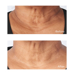Perricone MD, Cold Plasma Plus+ Sub-D/Neck Treatment, 59ML