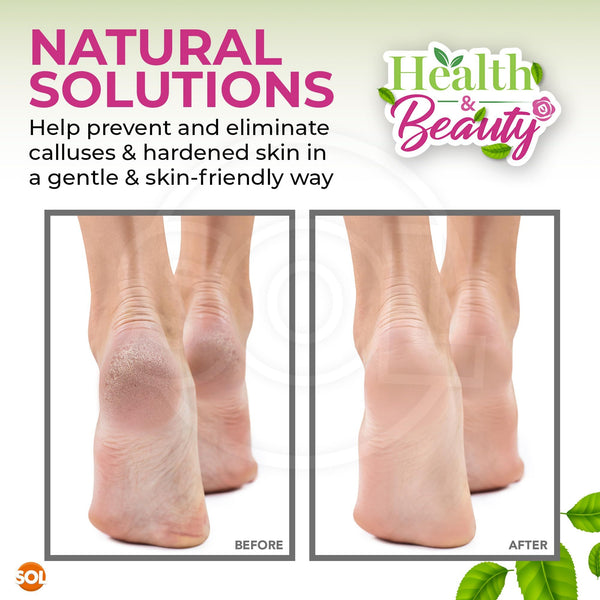 SOL 8pk Natural Pumice Stone for Feet | Callus Remover & Foot Scrubber | Exfoliating Stone for Dead Skin, Hard Skin, and Cracked Heels | Gentle Foot Buffer for Smooth, Soft, Healthy Skin